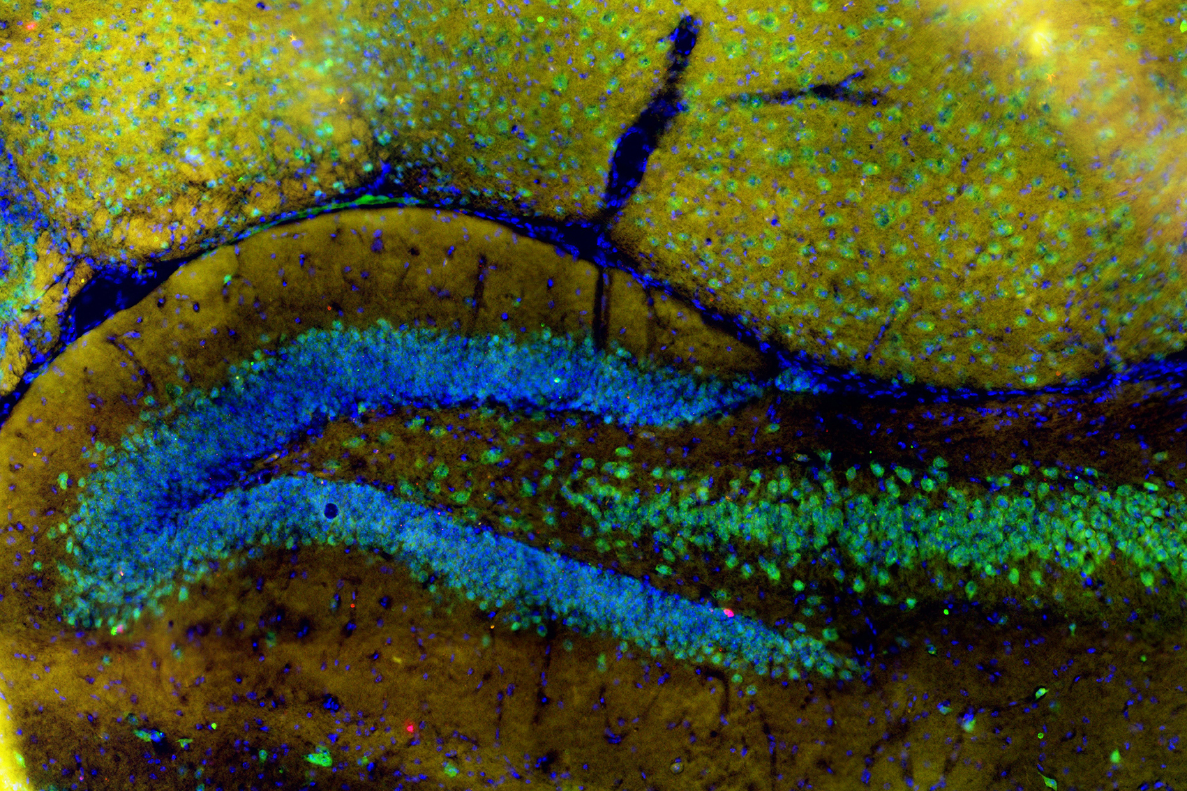 Neurones de l’hippocampe (en vert)