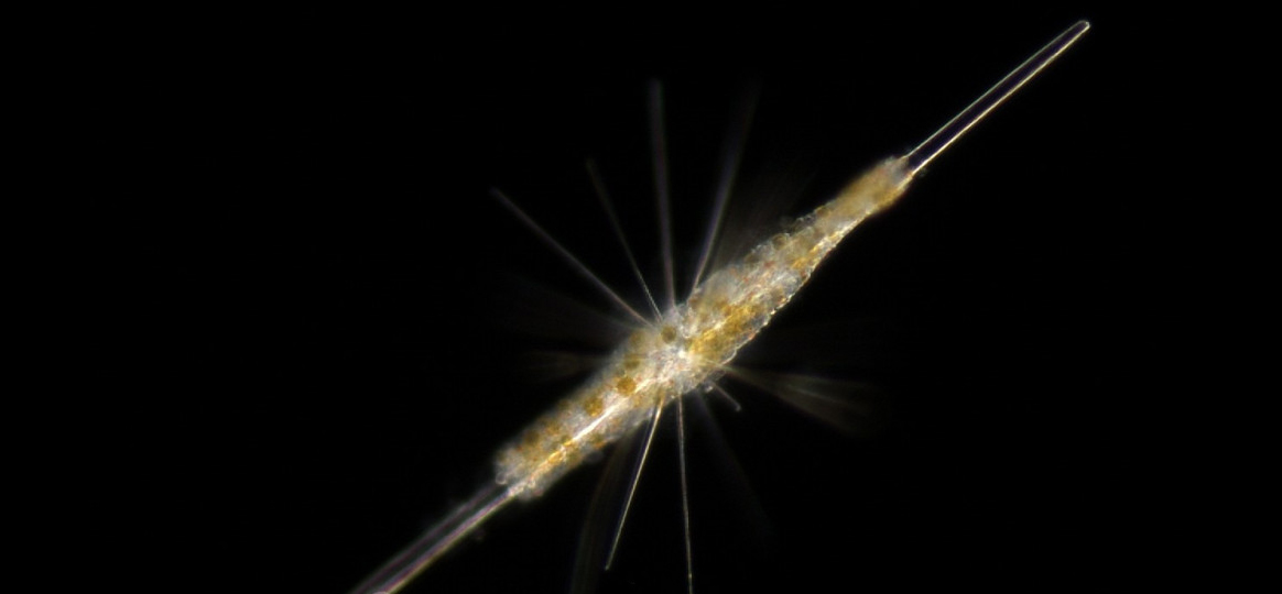Un acanthaire (hote) de 100-200 µm de longueur avec ses micro-algues symbiotiques intracellulaires (cellules jaune). Crédit : Johan Decelle