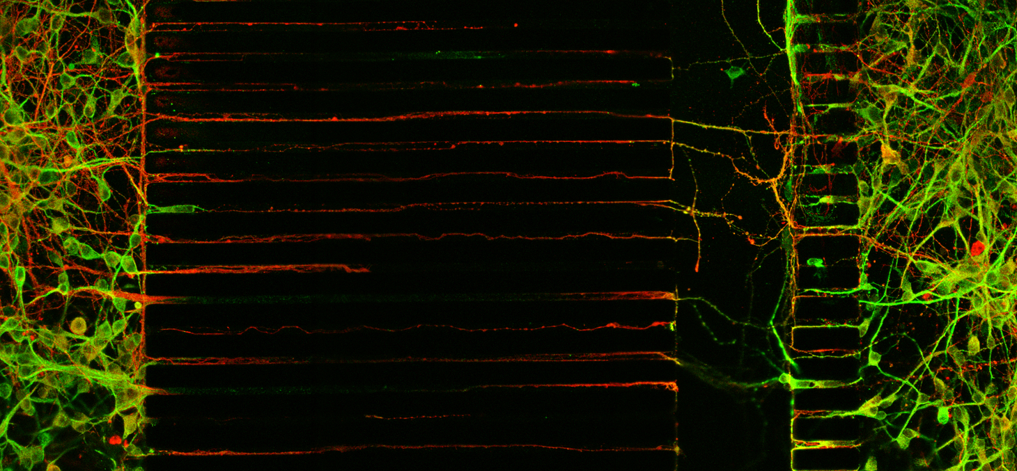 Dispositifs microfluidiques pour l’analyse du transport des vésicules dans les neurones © Maxime Cazorla