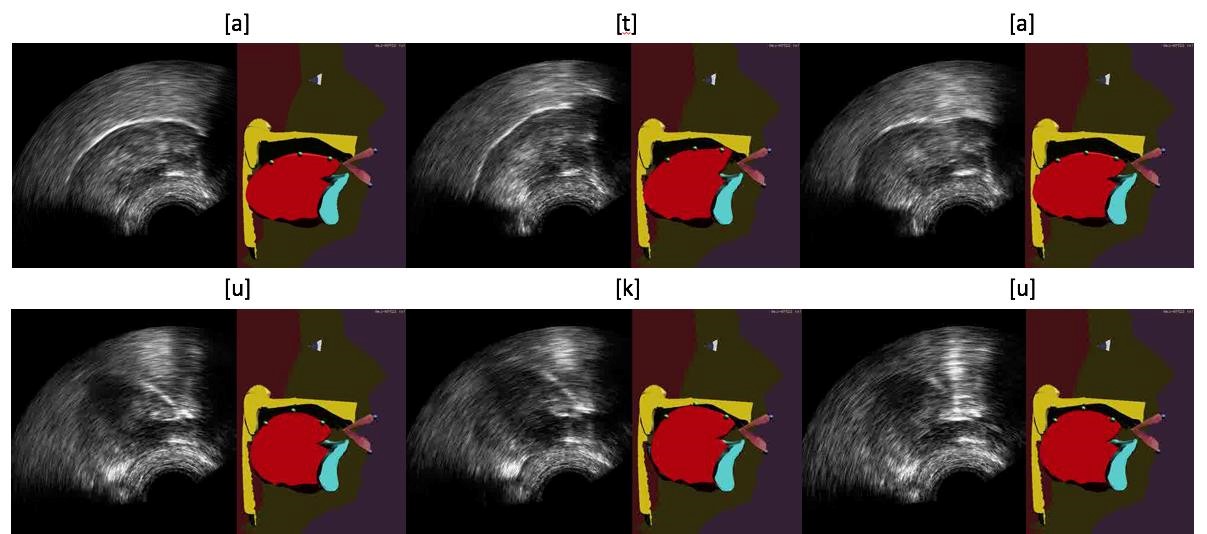 Exemple d’animations du modèle de langue de la tête parlante articulatoire du GIPSA-lab à partir d’images échographiques, à l’aide de l’algorithme "Integrated Cascaded Gaussian Mixture Regression". 