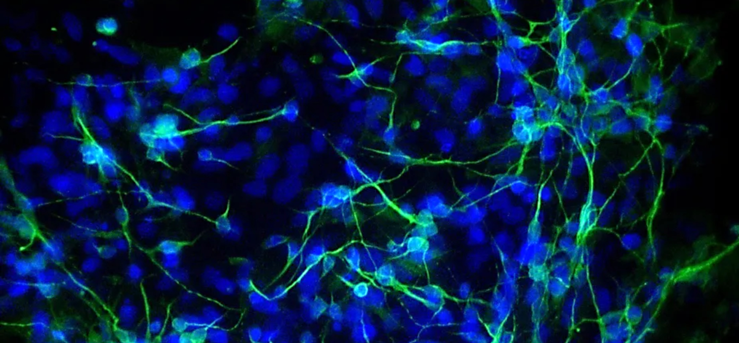 Cellules neurales différenciées à partir de la lignée embryonnaire ectodermique d'un corps embryoïde. Author provided