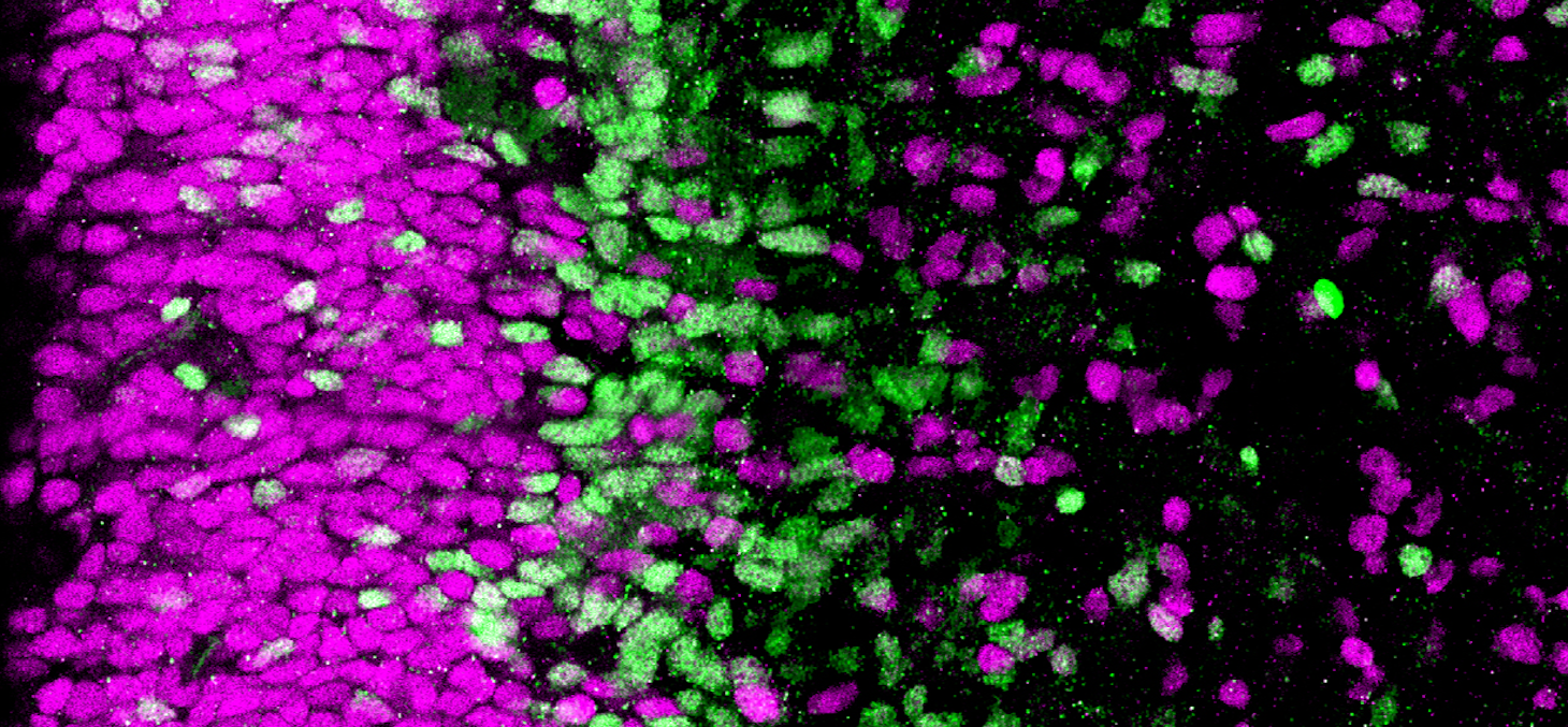 Coupe de cerveau humain (cortex). Les cellules progénitrices en magenta sont moins engagées dans la différenciation neuronale que celles en vert © Monia Barnat/Grenoble Institut des Neurosciences/Inserm, Université Grenoble Alpes