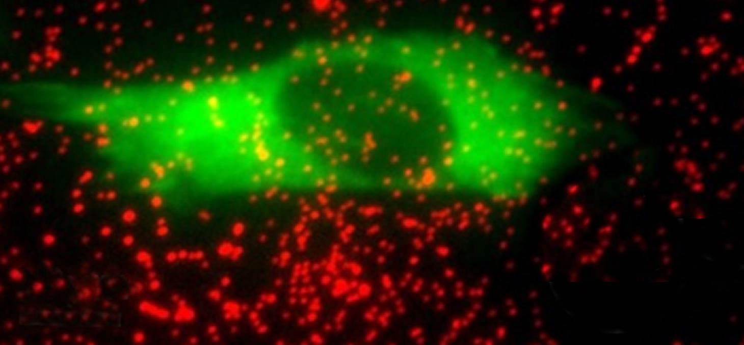 Visualisation en microscopie de fluorescence de la cellule (marqueur fluorescent vert) et des billes (en rouge).