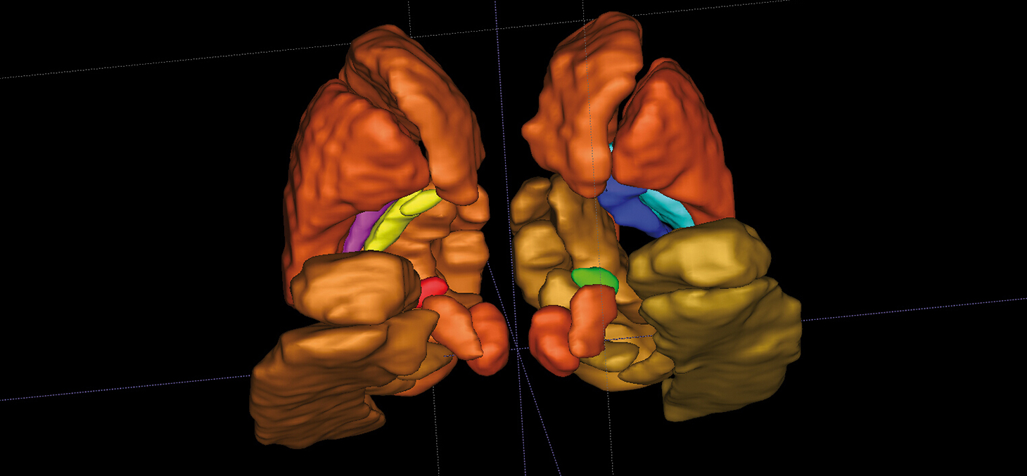 Structures cérébrales profondes en 3D des 2 hémisphères du cerveau ©Inserm/U746