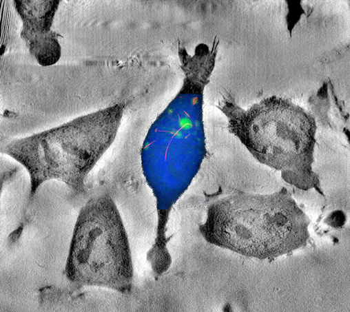 Nanowire crumpling or membrane puncturing determines toxicity.